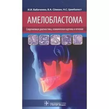Амелобластома: современная диагностика, клиническая картина и лечение. Бабиченко И. И.