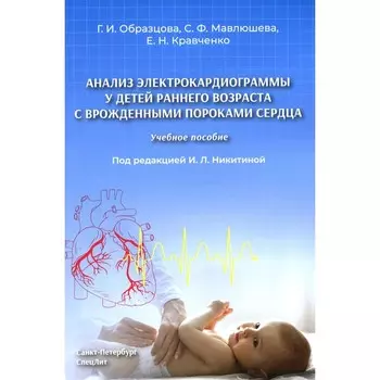 Анализ электрокардиограммы у детей раннего возраста с врожденными пороками сердца. Учебное пособие. Кравченко Е.Н., Образцова Г.И., Мавлюшева С.Ф.