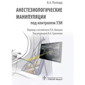 Анестезиологические манипуляции под контролем УЗИ