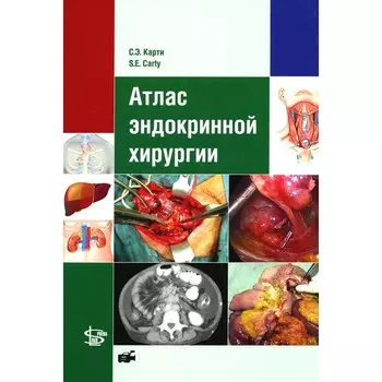Атлас эндокринной хирургии. Карти С.Э.