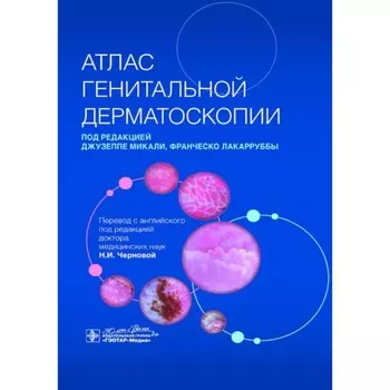 Атлас генитальной дерматоскопии. Под ред. Микали Дж., Лакарруббы Ф.