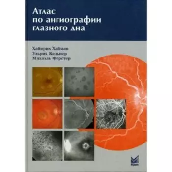 Атлас по ангиографии глазного дна. Хайман Х., Астахова Ю.С., Лисочкиной А.Б.