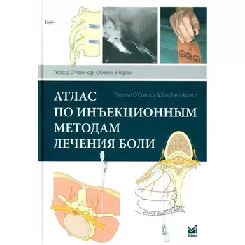 Атлас по инъекционным методам лечения боли. 2-е издание. О'Коннор Т., Эйбрам С.
