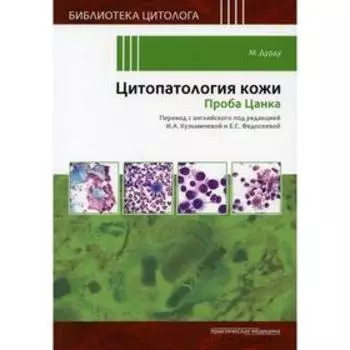 Цитопатология кожи. Проба Цанка. Дурду М.