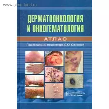 Дерматоонкология и онкогематология. Атлас. Под ред. Олисовой О.Ю.