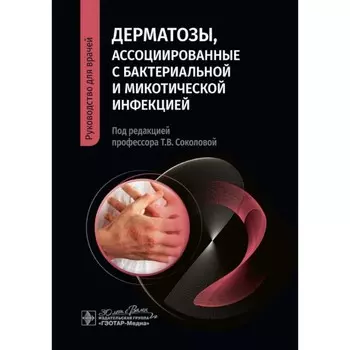 Дерматозы, ассоциированные с бактериальной и микотической инфекцией. Руководство для врачей. Лопатина Ю.В., Соколова Т.В., Малярчук А.П.