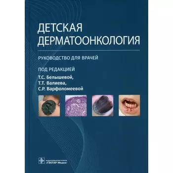 Детская дерматоонкология. Руководство для врачей. Варфоломеева С.Р., Белышева Т.С., Валиев Т.Т.