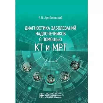 Диагностика заболеваний надпочечников с помощью КТ и МРТ. Араблинский А.В.