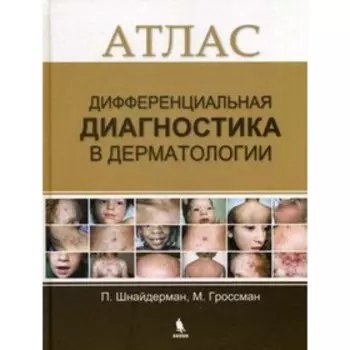 Дифференциальная диагностика в дерматологии. Шнайдерман П.