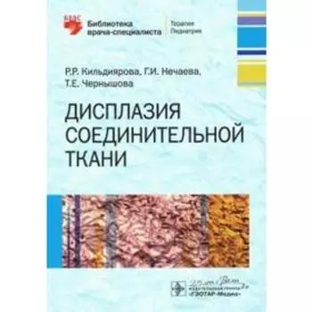 Дисплазия соединительной ткани. Кильдиярова Р.