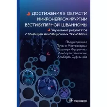 Достижения в области микронейрохирургии вестибулярной шванномы