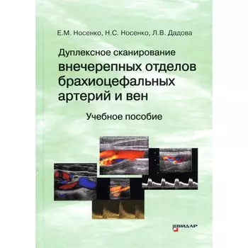 Дуплексное сканирование внечерепных отделов брахиоцефальных артерий и вен. Носенко Е.М., Носенко Н.С., Дадова Л.В