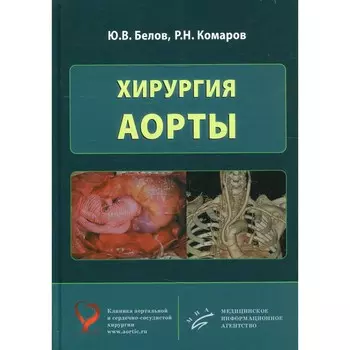 Хирургия аорты. Белов Ю.В., Комаров Р.Н.