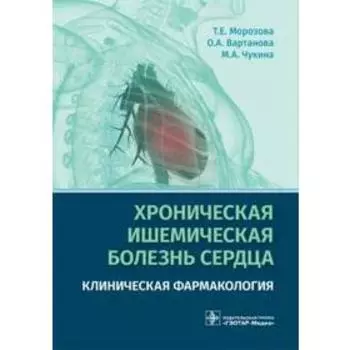 Хроническая ишемическая болезнь сердца. Морозова Т.