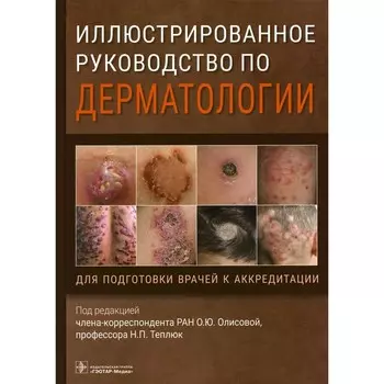 Иллюстрированное руководство по дерматологии. Для подготовки врачей к аккредитации. Под ред. Олисовой О.Ю., Теплюк Н.П.
