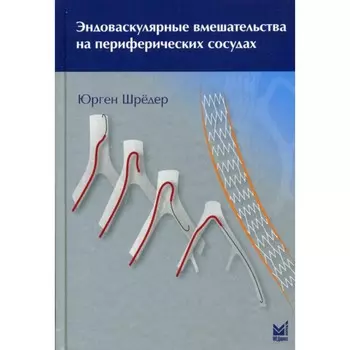 Эндоваскулярные вмешательства на периферических сосудах. Шредер Ю.
