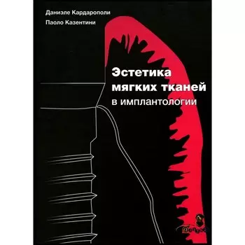 Эстетика мягких тканей в имплантологии. Кардарополе Д., Казентини П.