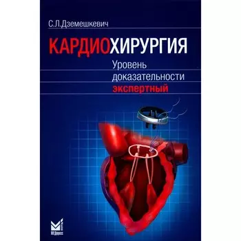Кардиохирургия. Уровень доказательности: экспертный. Дземешкевич С.Л.