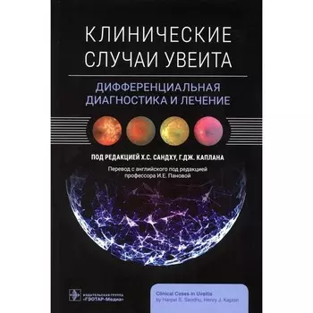 Клинические случаи увеита. Дифференциальная диагностика и лечение. Под ред. Сандху Х.С.
