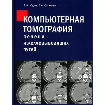 Компьютерная томография печени и желчевыводящих путей. Практическое руководство. Юдин А.Л., Юматова Е.А.