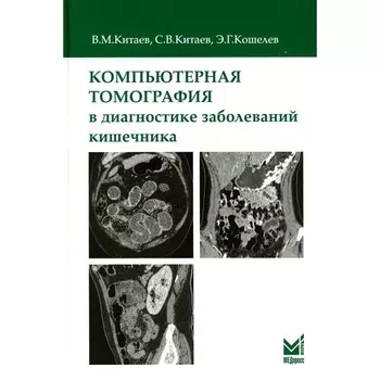 Компьютерная томография в диагностике заболеваний кишечника. 2-е издание. Китаев В.М., Китаев С.В., Кошелев Э.Г.
