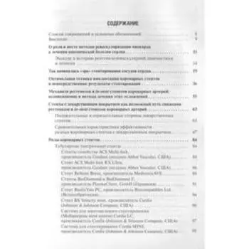 Коронарное стентирование и стенты. Иоселиани Д.