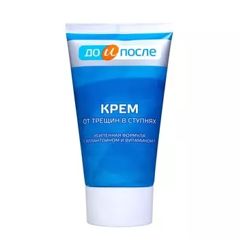 Крем для ног "До и После" от трещин в ступнях, 2 шт по 150 мл