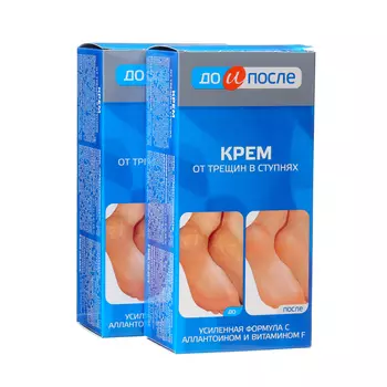 Крем для ног "До и После" от трещин в ступнях, 2 шт по 150 мл