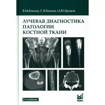 Лучевая диагностика патологии костной ткани. 2-е издание. Китаев В.М., Китаев С.В., Бронов О.Ю.
