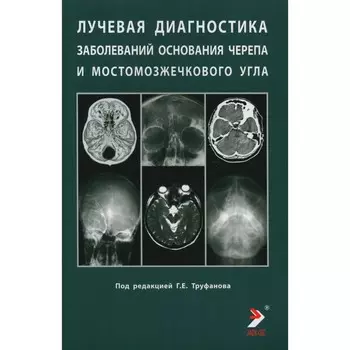 Лучевая диагностика заболеваний оснований черепа и мостмозжечкового угла. Учебное пособие. Под ред. Труфанова Г.Е.