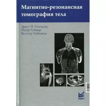 Магнитно-резонансная томография тела. 3-е издание. Руммени Э.Й., Раймер П., Хайндель В.