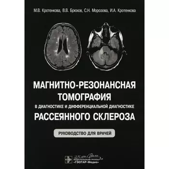 Магнитно-резонансная томография в диагностике и дифференциальной диагностике рассеянного склероза. Руководство для врачей. Кротенкова М.В., Брюхов В.В., Морозова С.Н.