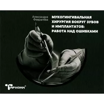Мукогингивальная хирургия вокруг зубов и имплантатов. Работа над ошибками. Февралева А.Ю.