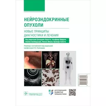 Нейроэндокринные опухоли. Новые принципы диагностики и лечения. Руководство для врачей. Под ред. Беретты Дж., Беррути А., Бомбардьери Э.