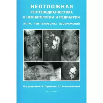 Неотложная рентгенодиагностика в неонатологии и педиатрии. Атлас рентгеновских изображений. Учебное пособие. 2-е издание. Под ред. Г.Е. Труфанова, Л.Г. Константиновой