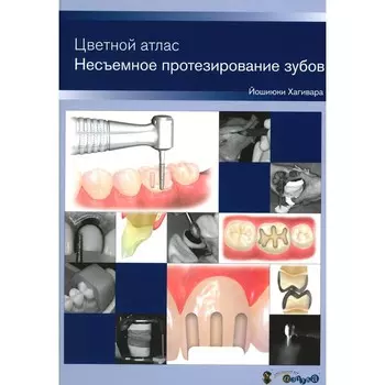 Несъемное протезирование зубов. Цветной атлас. Хагивара Й.