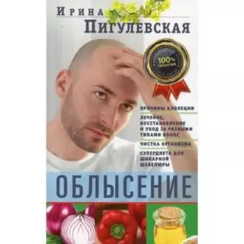 Облысение. Пигулевская И.С.