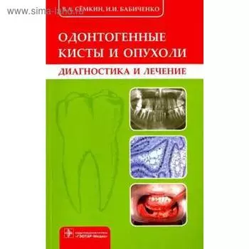 Одонтогенные кисты и опухоли (диагностика и лечение)