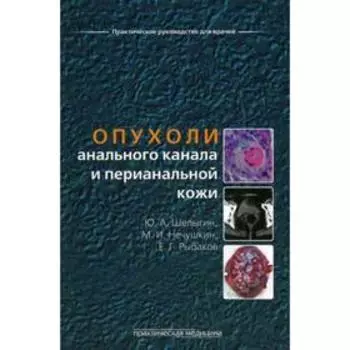 Опухоли анального канала и перианальной кожи. Шелыгин Ю.А.