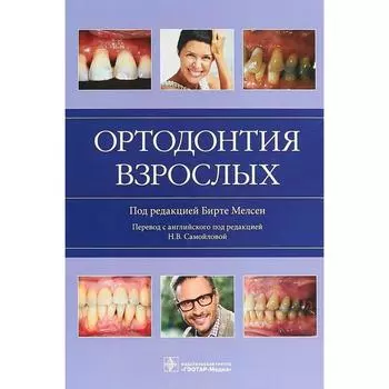 Ортодонтия взрослых. Под ред. Бирте М