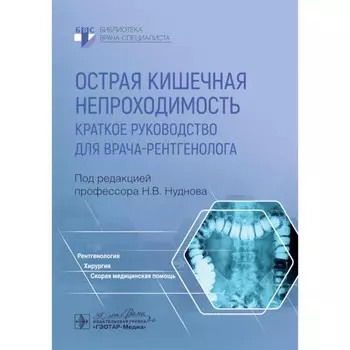 Острая кишечная непроходимость. Краткое руководство для врача-рентгенолога