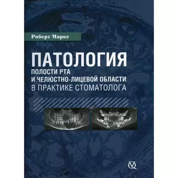 Патология полости рта и челюстно-лицевой области в практике стоматолога. Маркс Р.