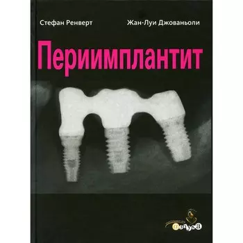 Периимплантит. Ренверт С., Джованьоли Ж.-Л.