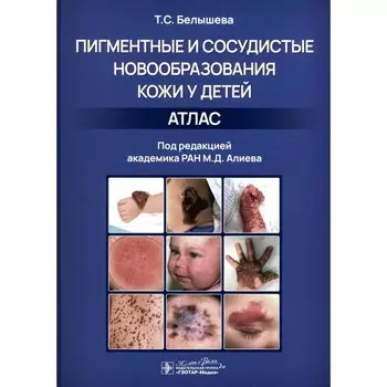 Пигментные и сосудистые новообразования кожи у детей. Атлас. Белышева Т.С.