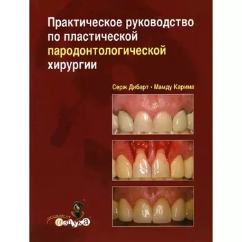 Практическое руководство по пластической парадонтологической хирургии. Дибарт С., Карима М.