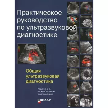 Практическое руководство по ультразвуковой диагностике. Общая ультразвуковая диагностика. 3-е издание, переработанное и дополненное. Под ред. Митькова В.В.