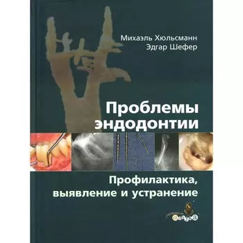 Проблемы эндодонтии. Профилактика, выявление и устранение. Аппель К., Арнольд М.