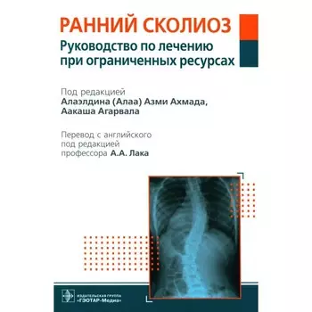 Ранний сколиоз. Руководство по лечению при ограниченных ресурсах. Под ред. Ахмада А.А., Агарвала А.