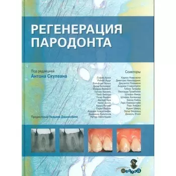 Регенерация пародонта. Черутти А.