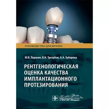 Рентгенологическая оценка качества имплантационного протезирования. Руководство для врачей. Трезубов В.Н., Паршин Ю.В., Зубарева А.А.